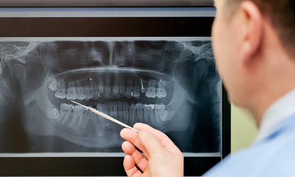 Joint Vibration Analysis
