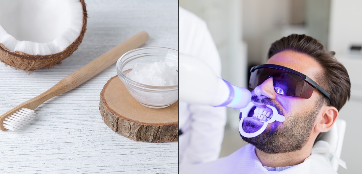 Professional vs DIY Teeth Whitening