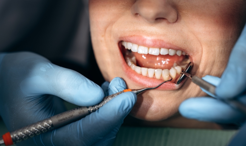 prevent cavities dr pak’s tips