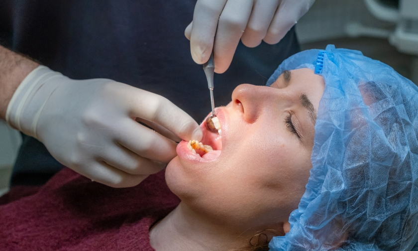 What Are The Best Practices For Preventing Root Decay In Adult Patients?