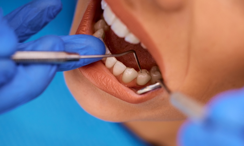 How Can Dr. Pak Help Rocklin Adults with Chronic Gum Bleeding?