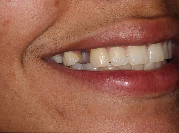 General Dentistry Rocklin: Your Complete Guide to a Healthier Smile